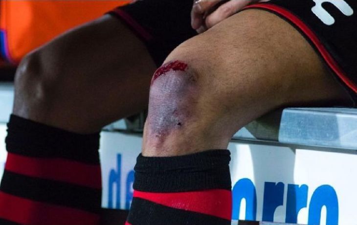 La impactante lesión de Bou que lo sacó de la cancha