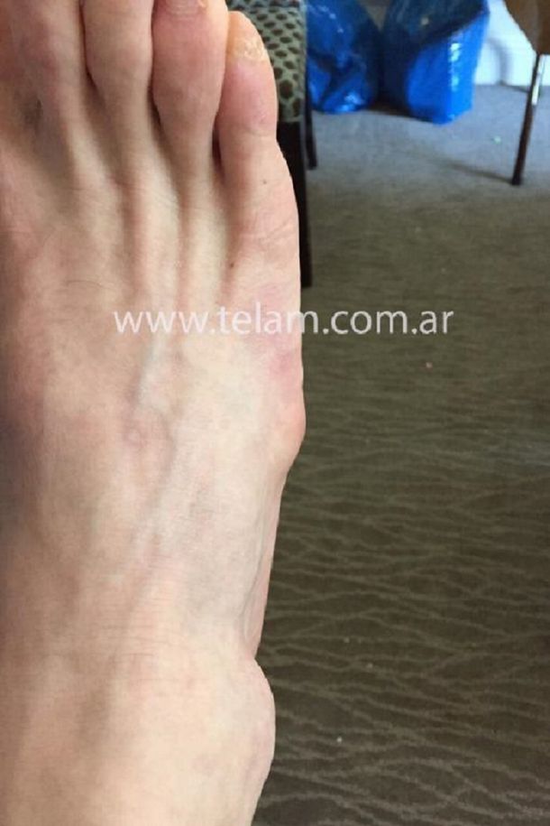 Ausencia justificada: el maltrecho pie de Messi que le impidió jugar en Estados Unidos