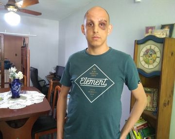 Federico Pasquali fue brutalmente golpeado pro patovicas.