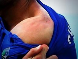 el jugador italiano agredido banco a luis suarez: fue excesiva la sancion el jugador italiano agredido banco a luis suarez: fue excesiva la sancion