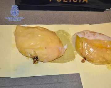 Los implantes mamarios eran bolsas de cocaína
