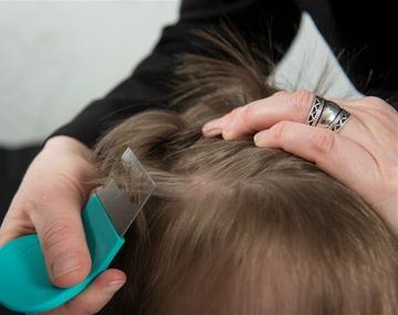 Invasión de piojos: tuvo 15 mil liendres en la cabeza y su caso se viralizó