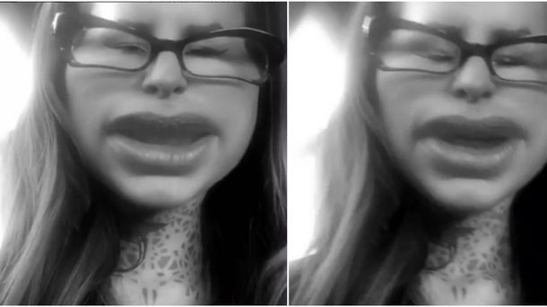 Cande Tinelli le responde a la gilada: Más botox, botox, botox