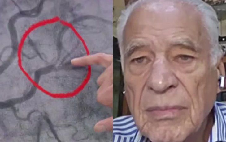 Cormillot contó el susto que vivió por un dolor en el pecho: qué fue lo que pasó