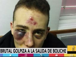 brutal golpiza a la salida de un boliche: le pegaron en el piso y quedo asi brutal golpiza a la salida de un boliche: le pegaron en el piso y quedo asi