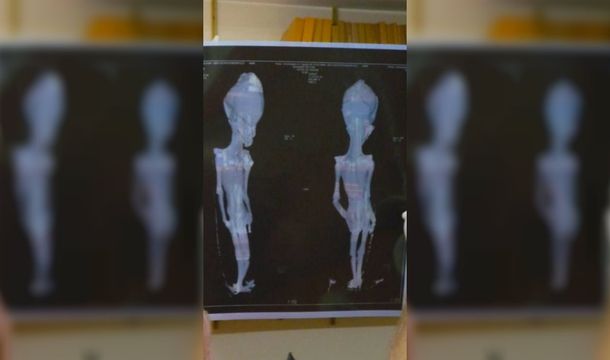 Al final no era un alien sino una bebé que murió al poco tiempo de nacer