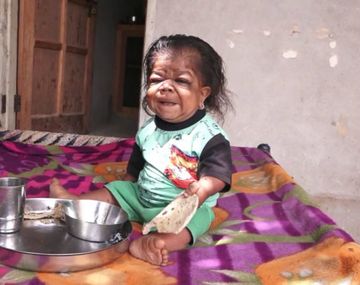 Manpreet tiene 23 años pero parece un bebé de seis meses