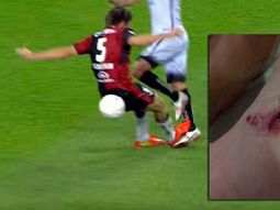 menos mal que son compatriotas: asi le dejo el tobillo kannemann a sambueza menos mal que son compatriotas: asi le dejo el tobillo kannemann a sambueza