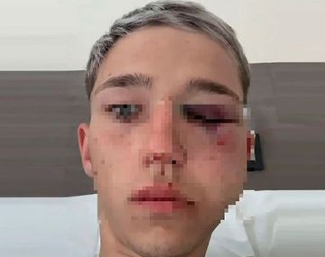 Imputan a cuatro rugbiers por la golpiza a un chico de 16 años pero quedaron en libertad