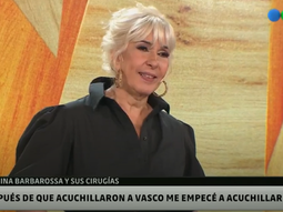 Georgina Barbarossa y su adicción a las cirugías: Aacuchillaron a mi marido y empecé a acuchillarme yo