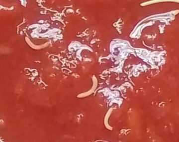 La ANMAT advierte por un lote de un alimento contaminado con gusanos