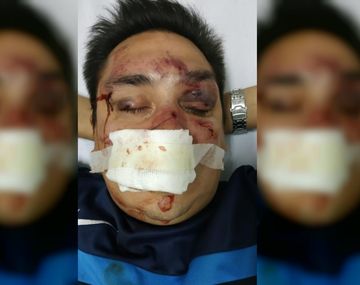 Sebastián Acosta fue brutalmente agredido por barras bravas de Rcaing.