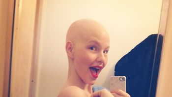 una historia de superacion: una modelo con cancer se muestra sin pelo una historia de superacion: una modelo con cancer se muestra sin pelo
