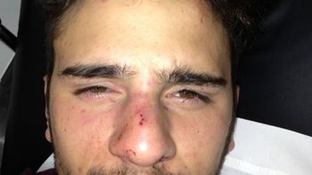 brutal golpiza a un joven por ser homosexual en san isidro brutal golpiza a un joven por ser homosexual en san isidro