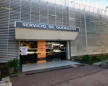 Limpiaba un instrumento con nafta y se quemó la mitad del cuerpo