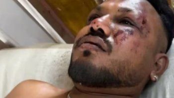 milagro en la tragedia de air india: encontraron a un sobreviviente