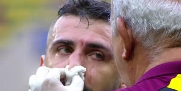 El ex delantero de Vélez podría jugar con una máscara