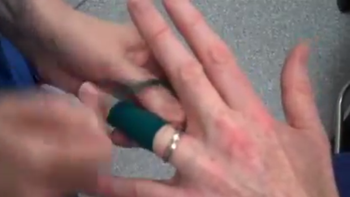 ¿como hacer para sacar un anillo de un dedo hinchado? ¿como hacer para sacar un anillo de un dedo hinchado?