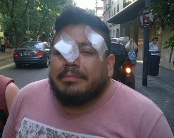 Daniel Sandoval perdió un ojo en una protesta contra la reforma previsional - Crédito: @valeriafgl