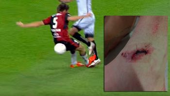 menos mal que son compatriotas: asi le dejo el tobillo kannemann a sambueza menos mal que son compatriotas: asi le dejo el tobillo kannemann a sambueza