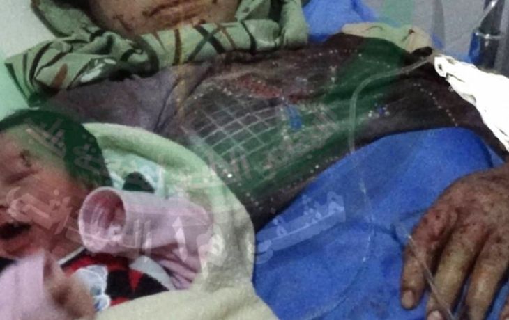 Nació con la herida de una bala en la frente