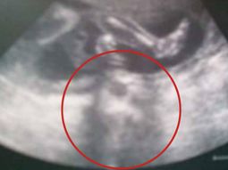 Una madre aseguró que vio la cara de Jesús en la ecografía de su bebé