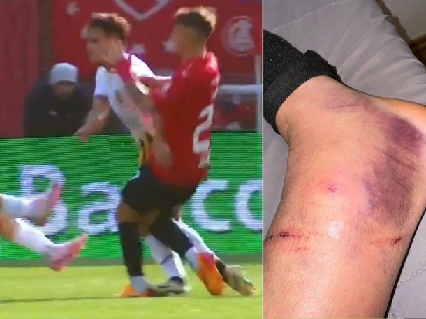 Impactante lesión de un jugador de Independiente: se perdería el clásico con Racing