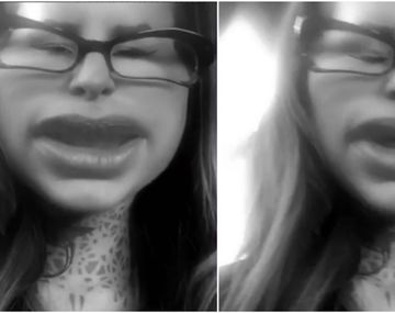 Cande Tinelli le responde a la gilada: Más botox