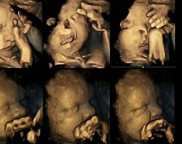 Así afecta una madre fumadora al feto 