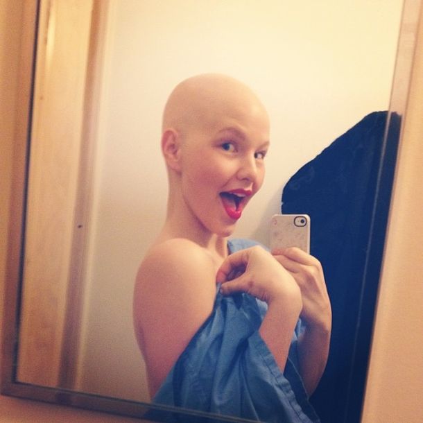 Una historia de superación: una modelo con cáncer se muestra sin pelo en sus campañas