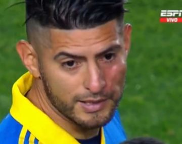 Zambrano salió con un golpe en el pómulo: ¿se peleó con Benedetto?
