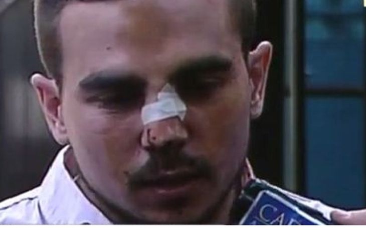 Denunció una brutal golpiza de patovicas