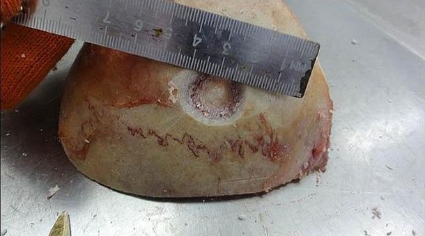 Así eran las cirugías cerebrales hace 2.300 años