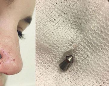 La mujer tuvo que ser atendida en un centro médico cercano