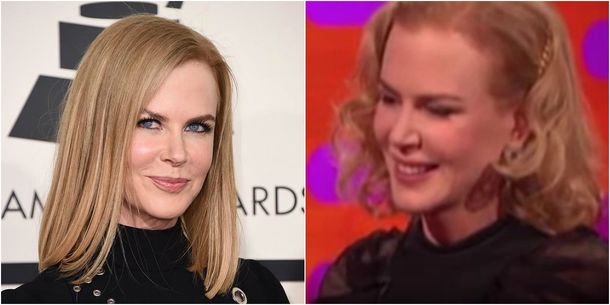 Nicole Kidman reapareció en TV con un rostro que apenas se dejó mover