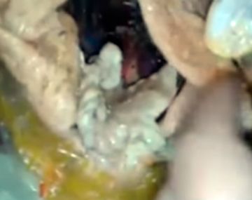 Compró pollo y encontró un gusano adentro