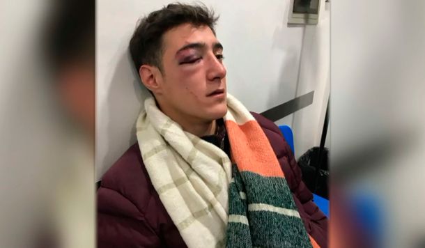 Le dieron un piedrazo en la cara