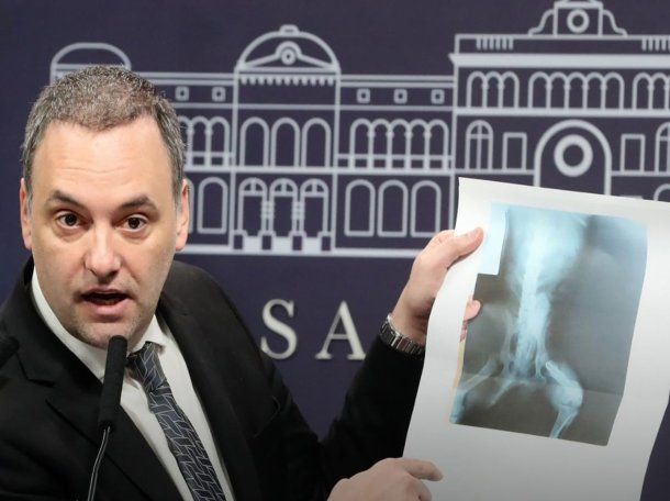 El Gobierno denunció un fraude millonario con las pensiones por invalidez