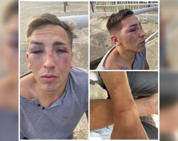 Brutal golpiza a un joven en un reconocido boliche de Costanera
