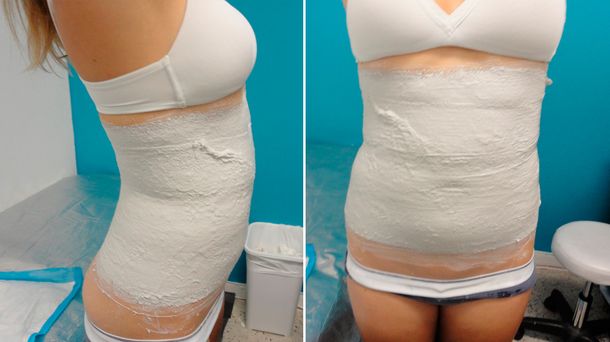 Llegó al país la yesoterapia, una técnica para modelar la figura