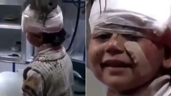 La sonrisa de la nena herida en Alepo La sonrisa de la nena herida en Alepo