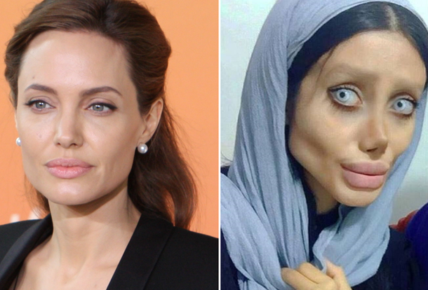 Se hizo 50 operaciones para parecerse a Angelina Jolie