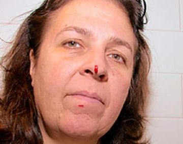 Un drone chocó e hirió a una mujer