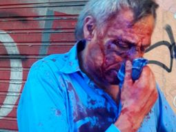 Cuatro líneas de colectivo están de paro por un brutal ataque a un chofer