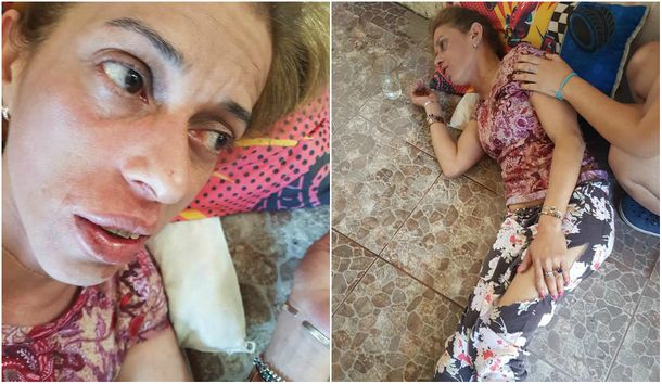 Golpearon a una delegada municipal de Quilmes