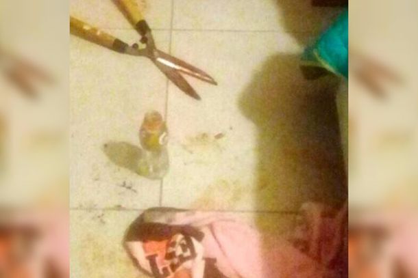 Se recupera el hombre al que su amante le cortó el pene