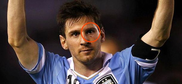 El tremendo golpe que casi le saca un ojo a Lionel Messi