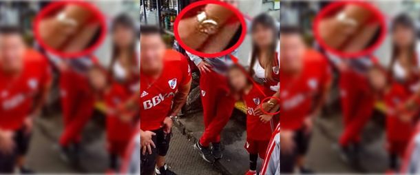 El reloj fue clave para identificar a la mujer que le pegó las bengalas al menor