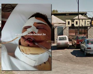 Salvaje golpiza de patovicas a un joven en un boliche de Florencio Varela