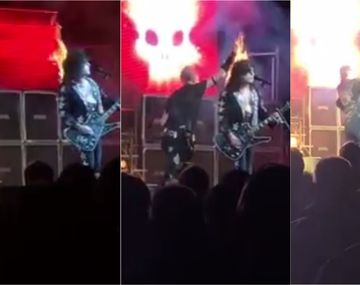 El show debe continuar: se le incendió el pelo pero siguió tocando igual